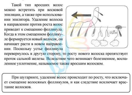 Как избавиться от вросших волос - секретный блог