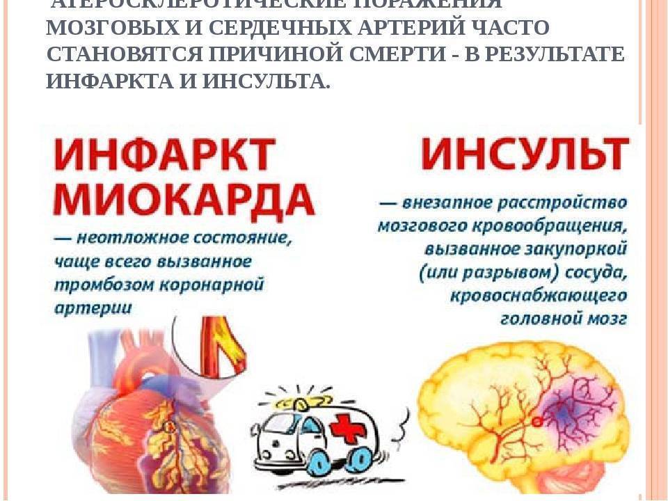 Инфаркт и инсульт головного мозга: что это такое, в чем разница