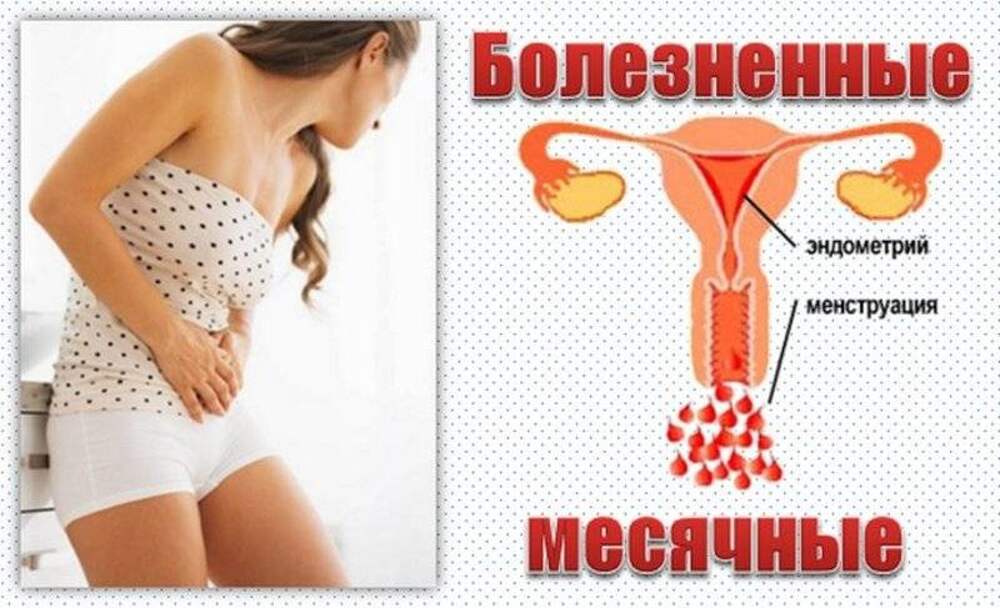 Сильные боли при месячных – почему и что делать, упражнения