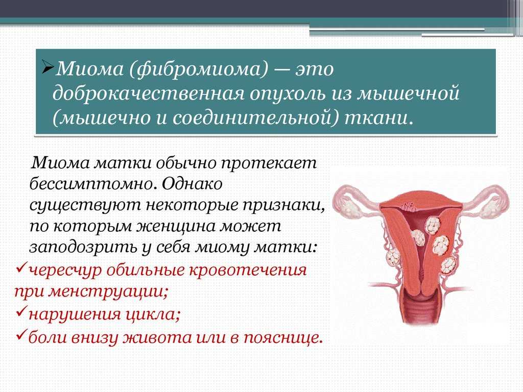Фіброміоми матки: симптоми та лікування: статті клініки оксфорд медікал київ