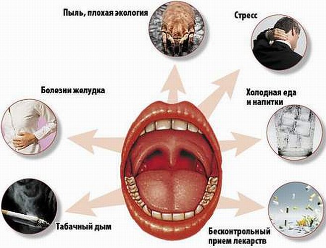 Острый ларингит – причины, симптомы, лечение