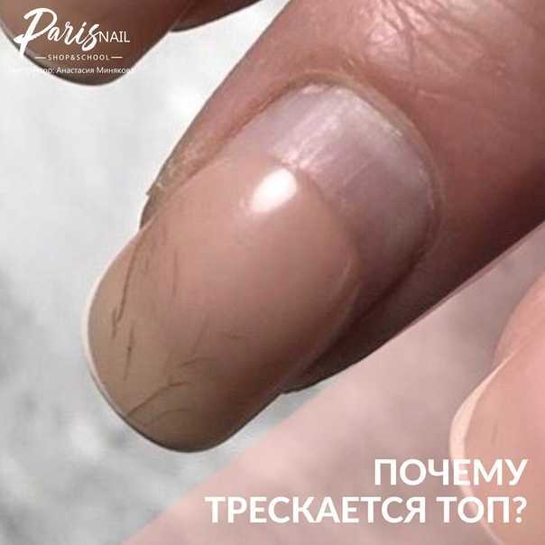 Что делать когда трескается гель лак на ногтях