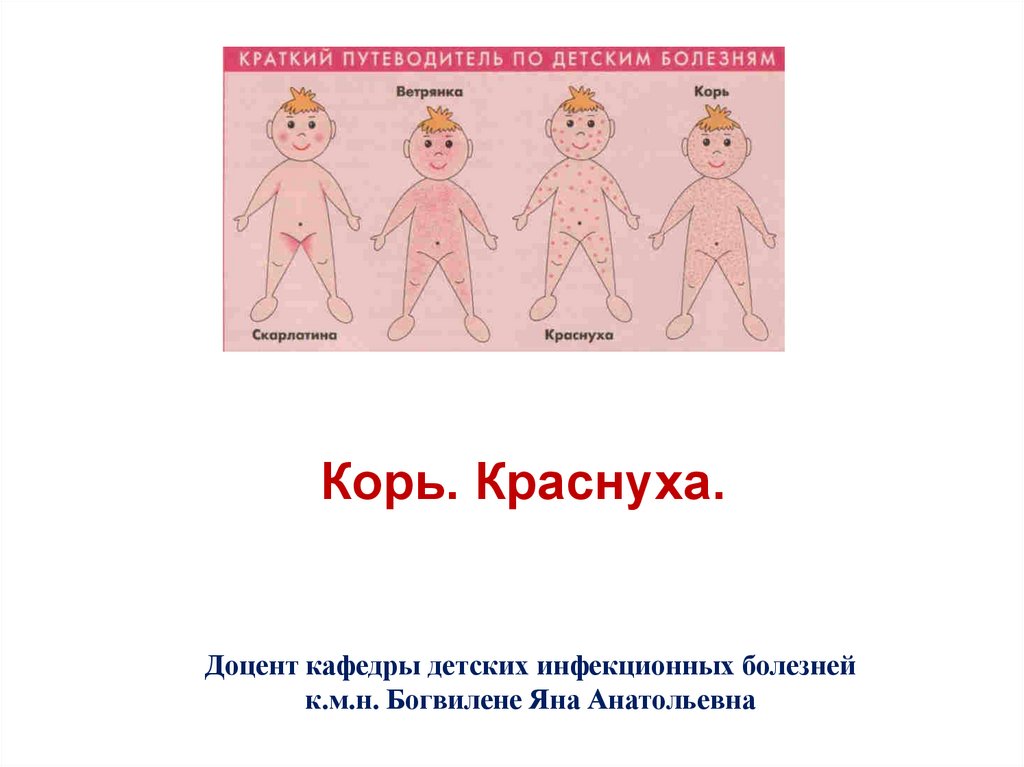 «детские» инфекции у взрослых