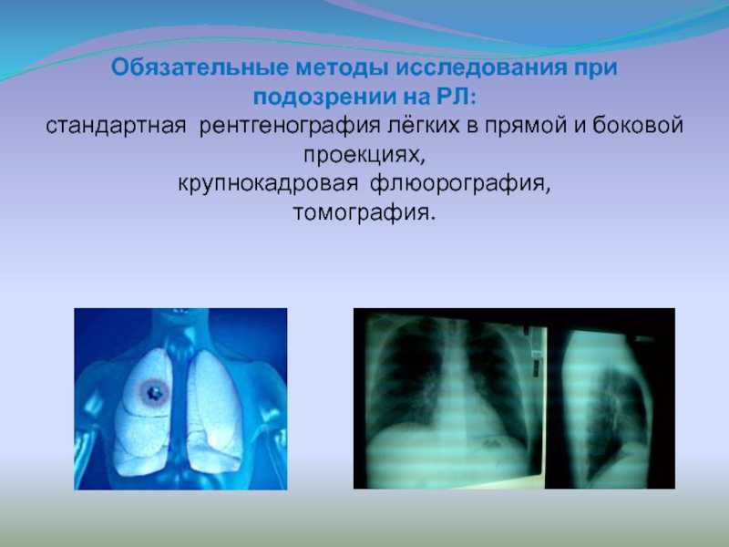 Чем отличается флюорография от рентгена лёгких: в каких случаях применяют