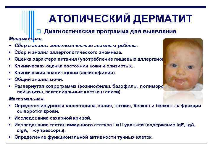 Аллергический дерматит - симптомы и лечение