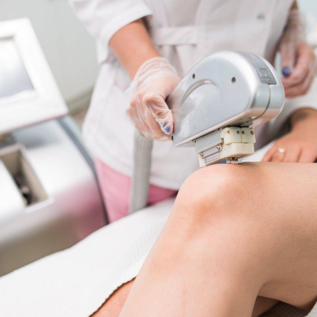 Фотоэпиляция.