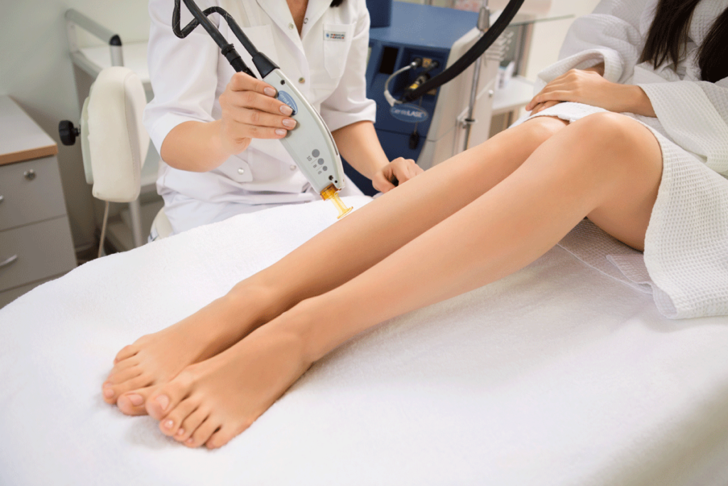 Лазерная эпиляция.