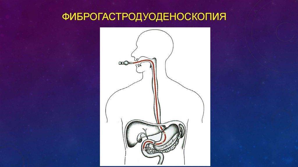 В чём разница между ФГС и ФГДС: что общего между ФГС и ФГДС, в чём отличие