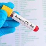 Анализ на гормон Т4 общий.