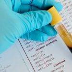 Т3 свободный и другие показатели.