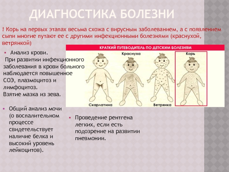 Корь и ветрянка одно и тоже или нет