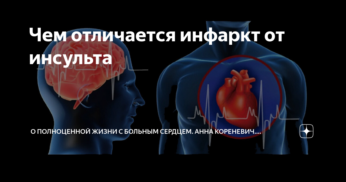 Инфаркт и инсульт – отличительные признаки