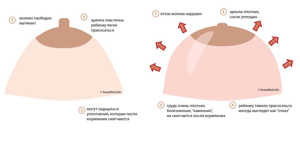 Маммология | боль в груди: 10 причин, по которым ваша грудь может болеть