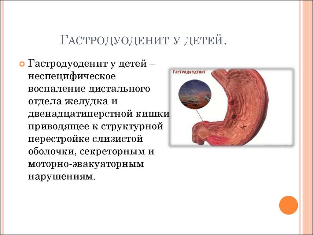 Гастрит и гастродуоденит - сеть медицинских центров медикер