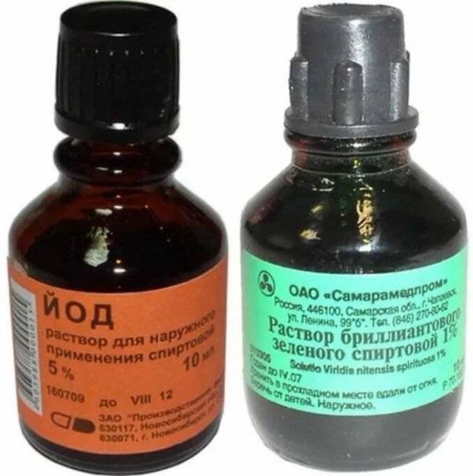 Принципиальное отличие между зеленкой и йодом - где кроется разница? - artikletop.ru