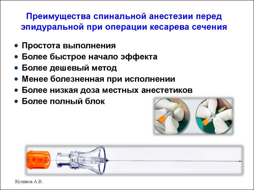 Спинальная и эпидуральная анестезия