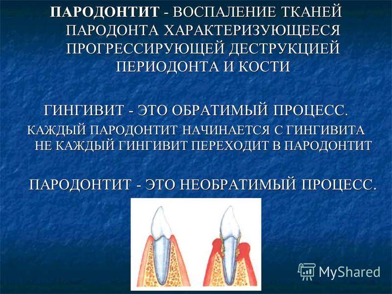 Пародонтит и пародонтоз: в чем отличие?