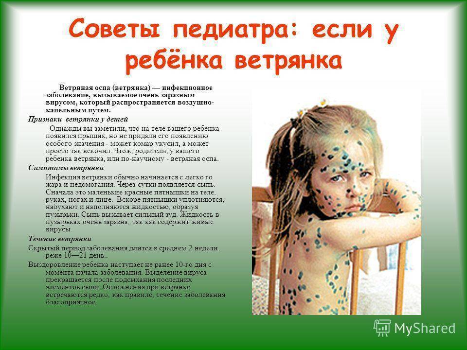 ➤ ветрянка у взрослых