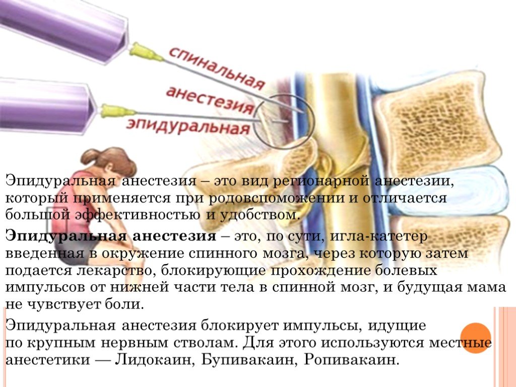 Спинальная анестезия и эпидуральная — в чем разница