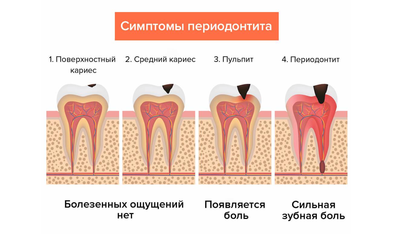 Болезни десен и зубов