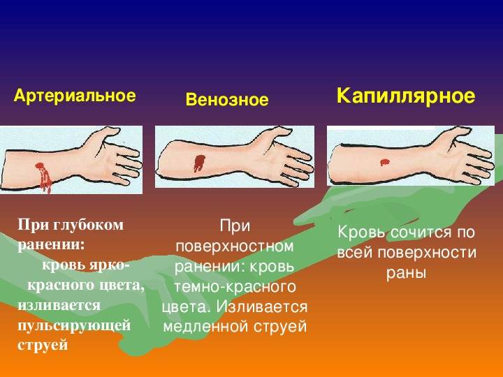 Артериальная и венозная кровь: чем отличается, первая помощь при кровотечениях