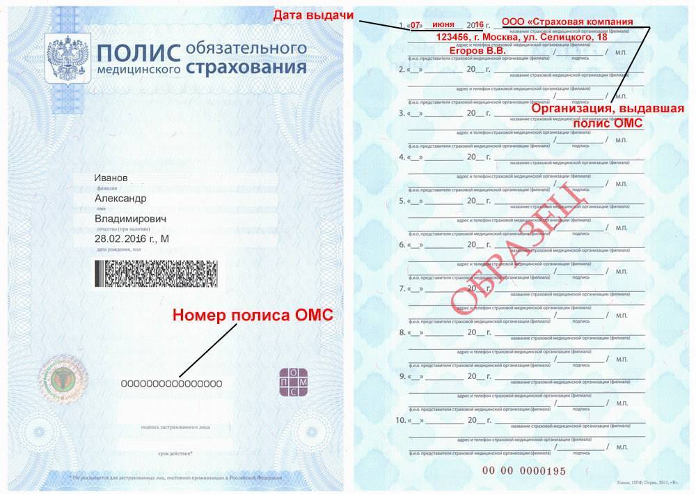В чем различия между дмс, нс и соз