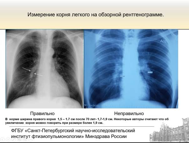Чем кт отличается от мрт, узи и рентгена?