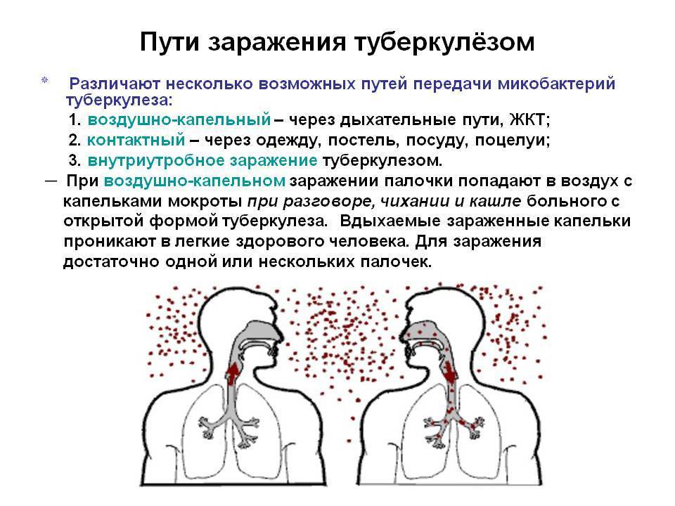 15 важных вопросов фтизиатру ольге винокуровой о туберкулезе - медицинский портал "здоровая чувашия"