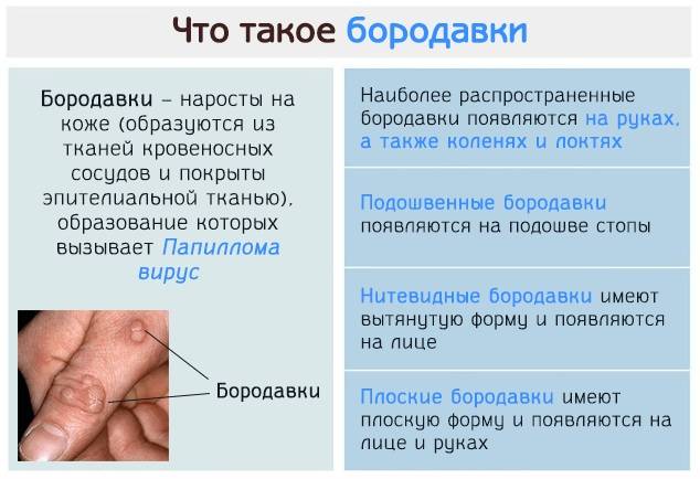 Чем отличается папиллома от бородавки, какая между ними разница?