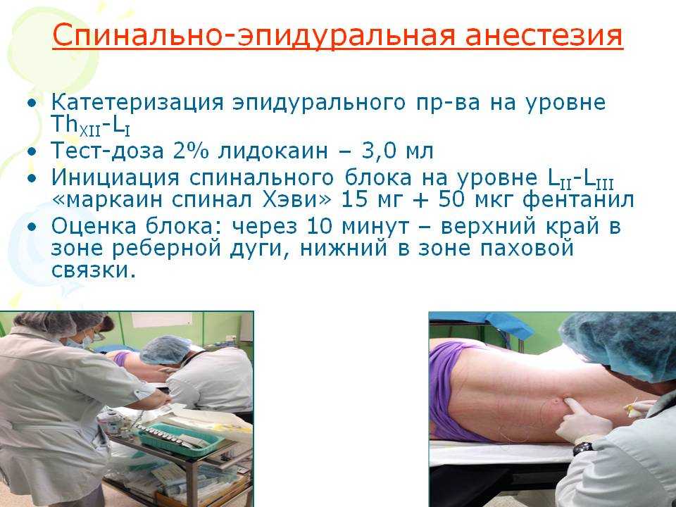 Спинальная анестезия и эпидуральная анестезия в чем разница между