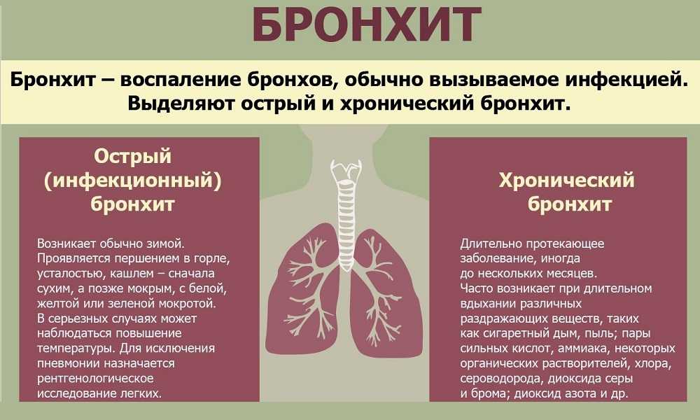 Бронхит: как распознать, диагностировать и вылечить заболевание