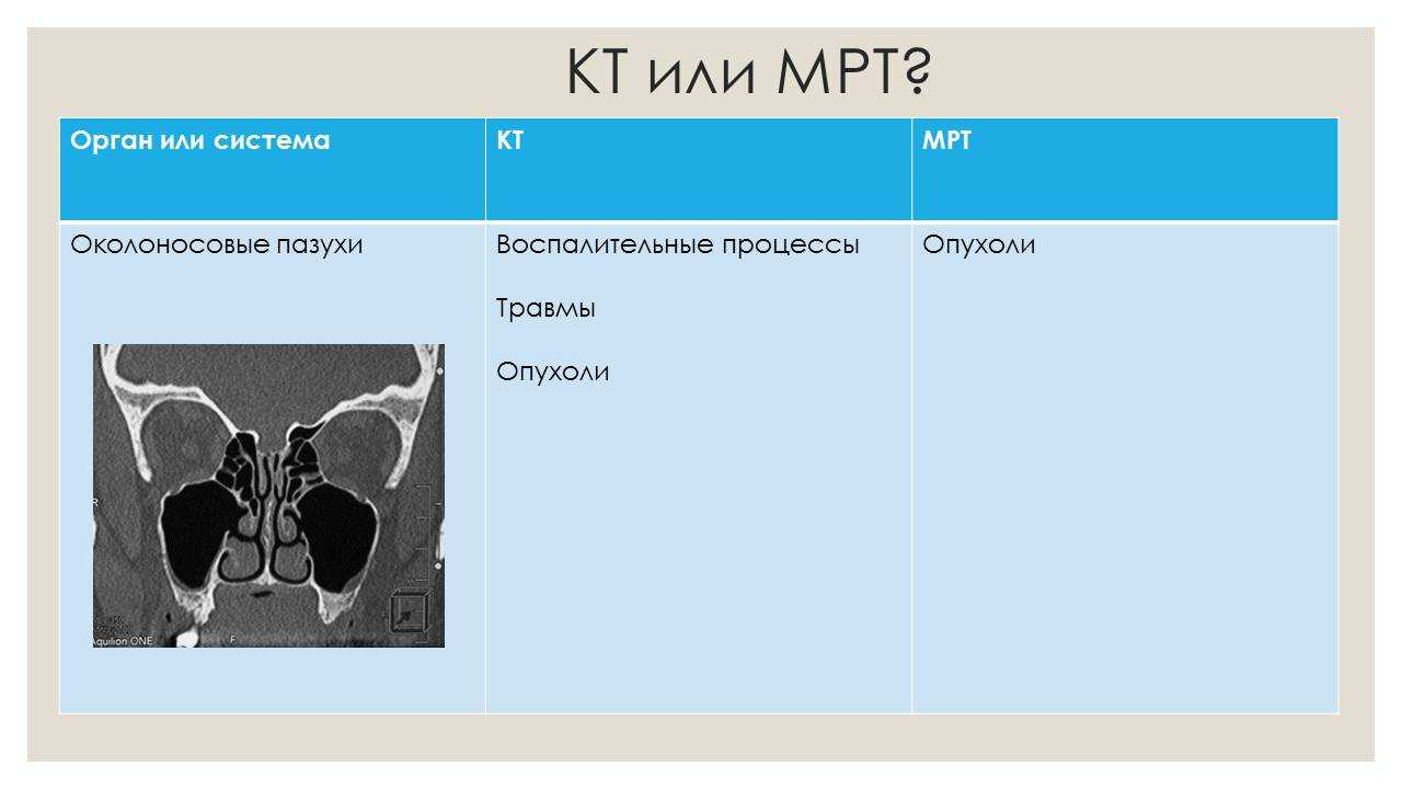 Чем отличается кт от мрт, рассказал врач-рентгенолог