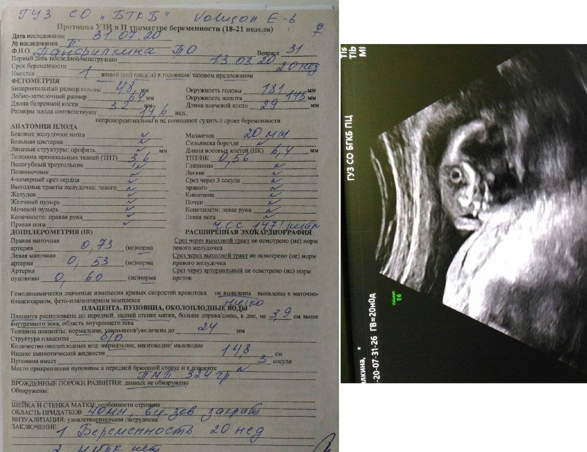 Чем отличается узи от скрининга: описание и отличия | в чем разница