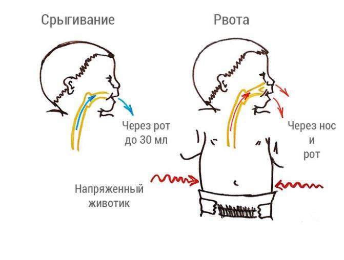 Рвота у грудничка: причины, первая помощь и лечение