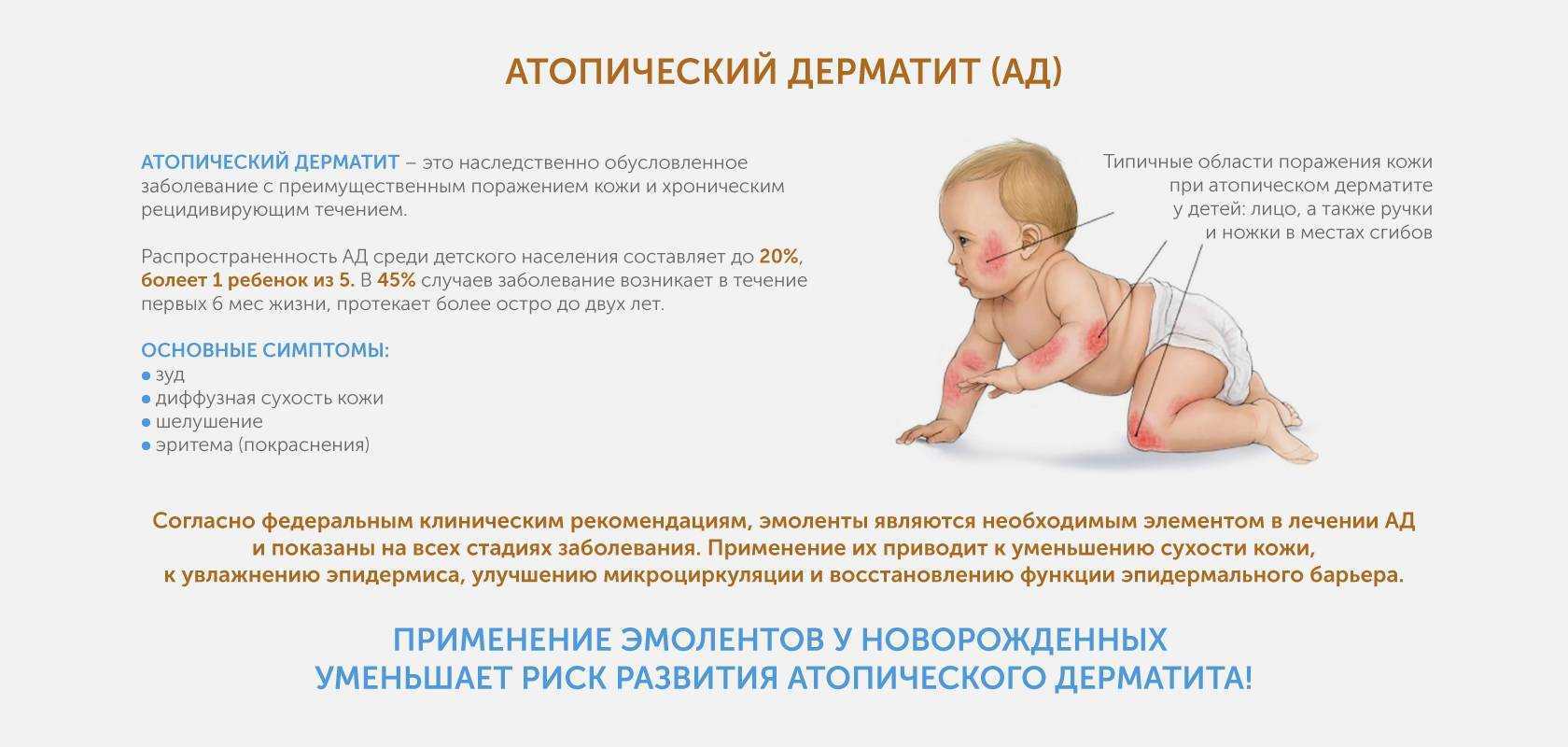 Чем лечить аллергический дерматит у взрослых и детей? симптомы и фото