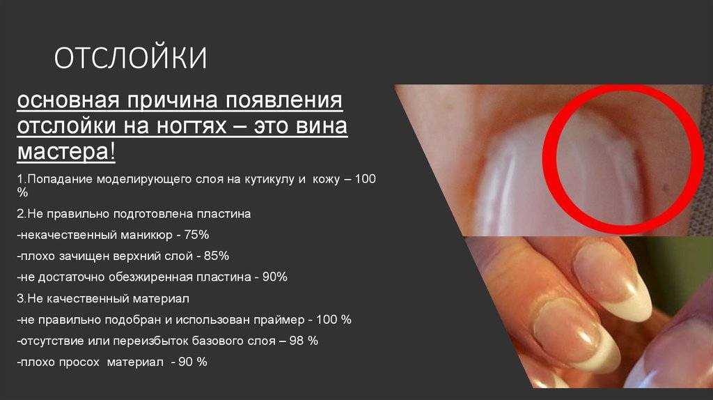 Что делать, чтобы не отслаивался гель-лак. основные ошибки при нанесении гель-лака | школа красоты