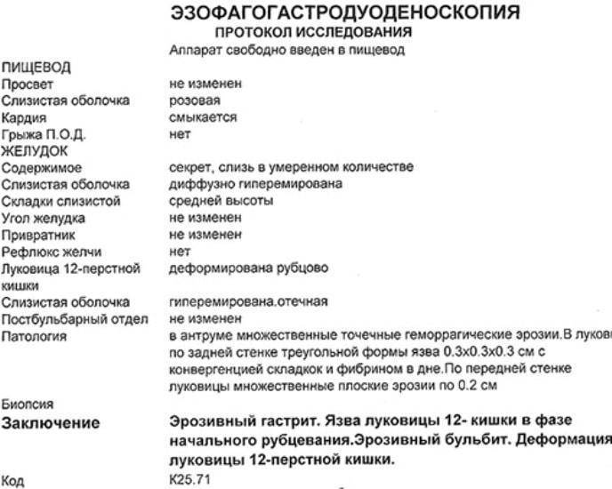 Как проводится гастроскопия под наркозом и без — симптомы, диагностика, лечение в нкц№2 (цкб ран)
