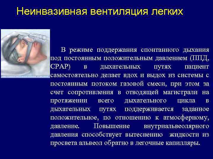 Неинвазивная искусственная вентиляция легких