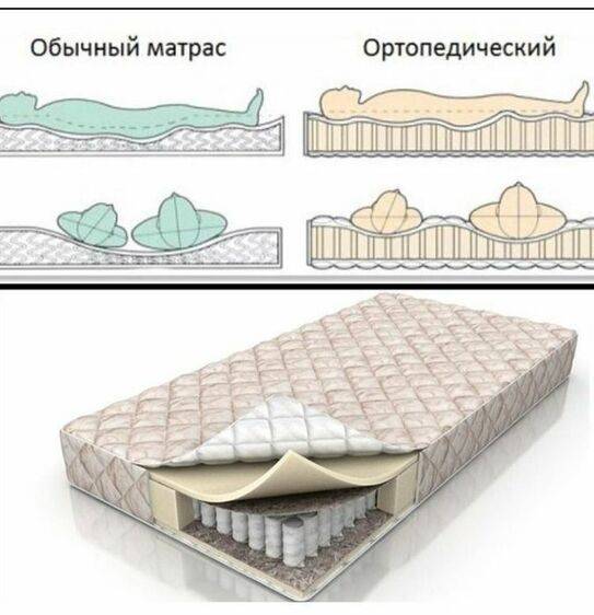 Лучшие ортопедические матрасы – все виды, их преимущества и недостатки
