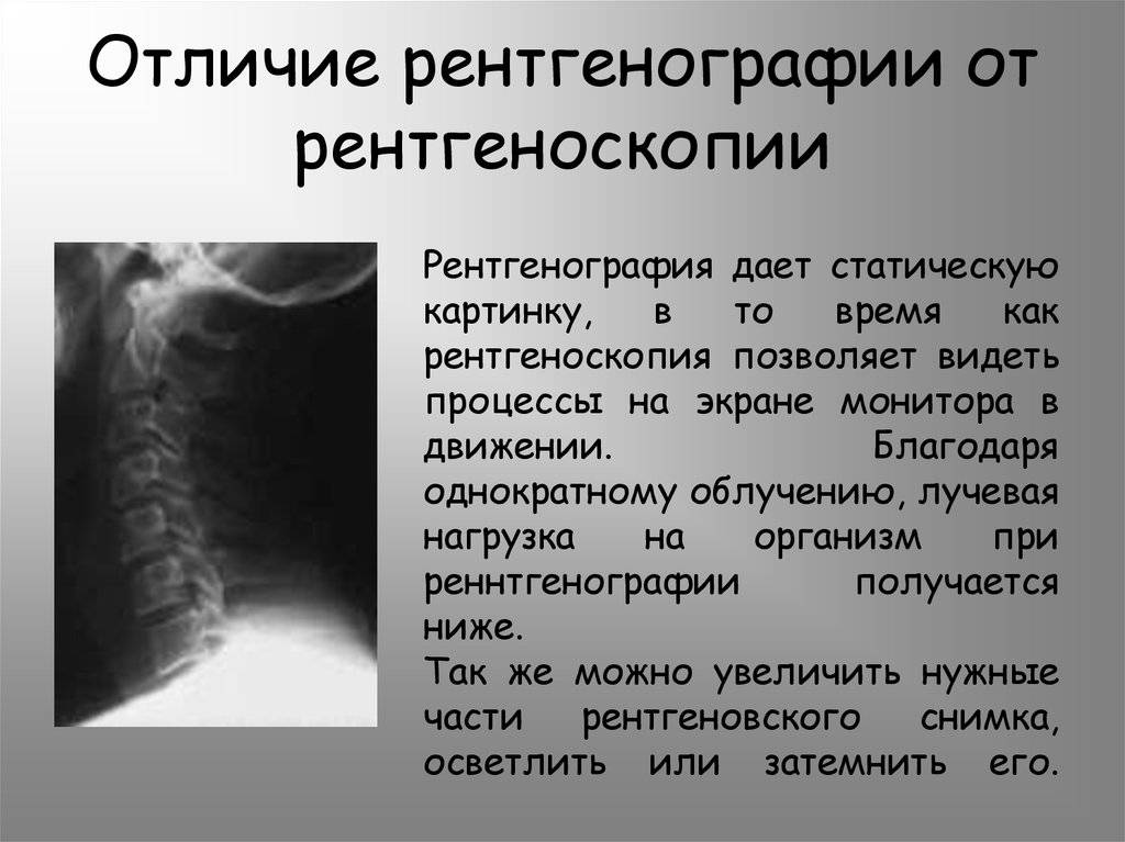 Что вреднее, кт или рентген? сравнение компьютерной томографии и рентгенографии.