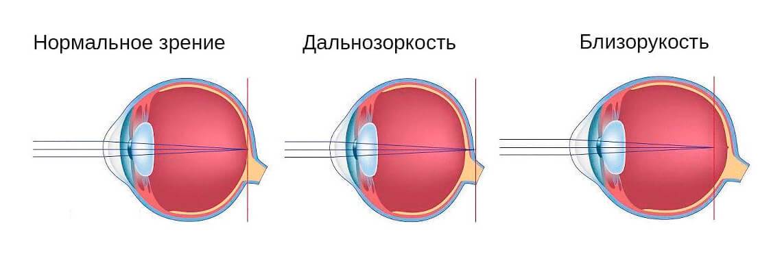 3.4. глаз как оптический инструмент