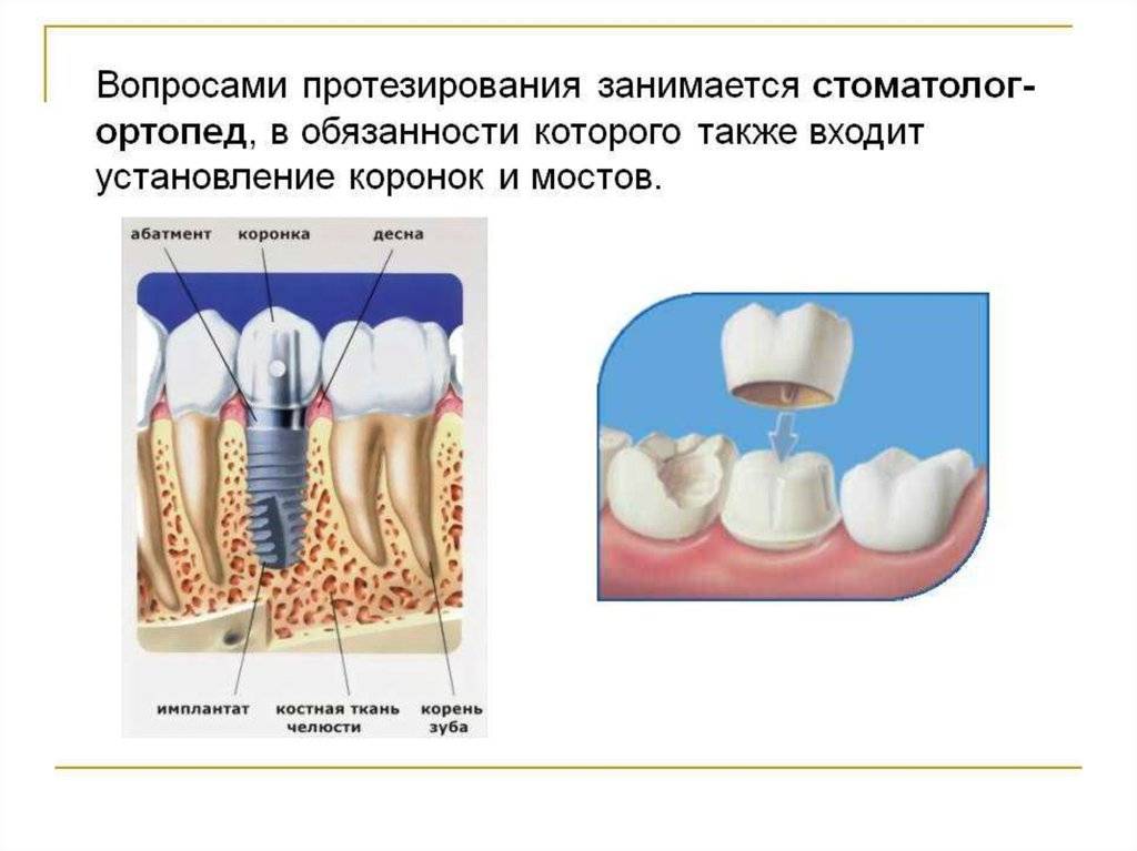 Что делает стоматолог-ортодонт
