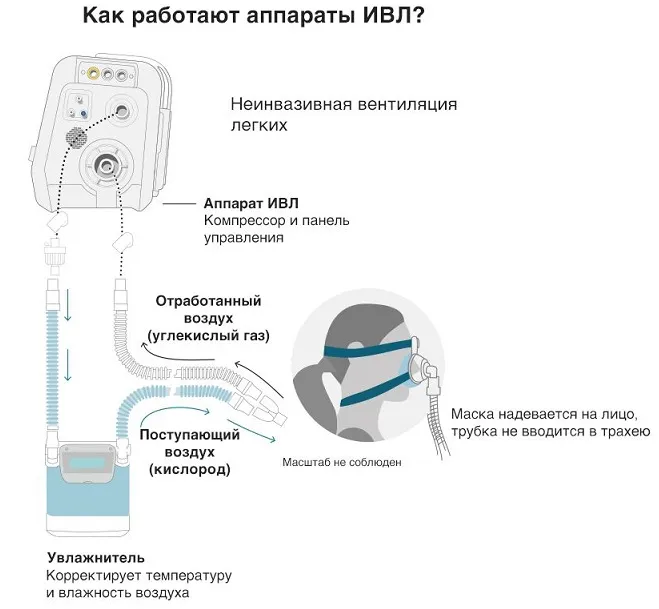Что такое инвазивное и неинвазивное ивл? отличия и применение