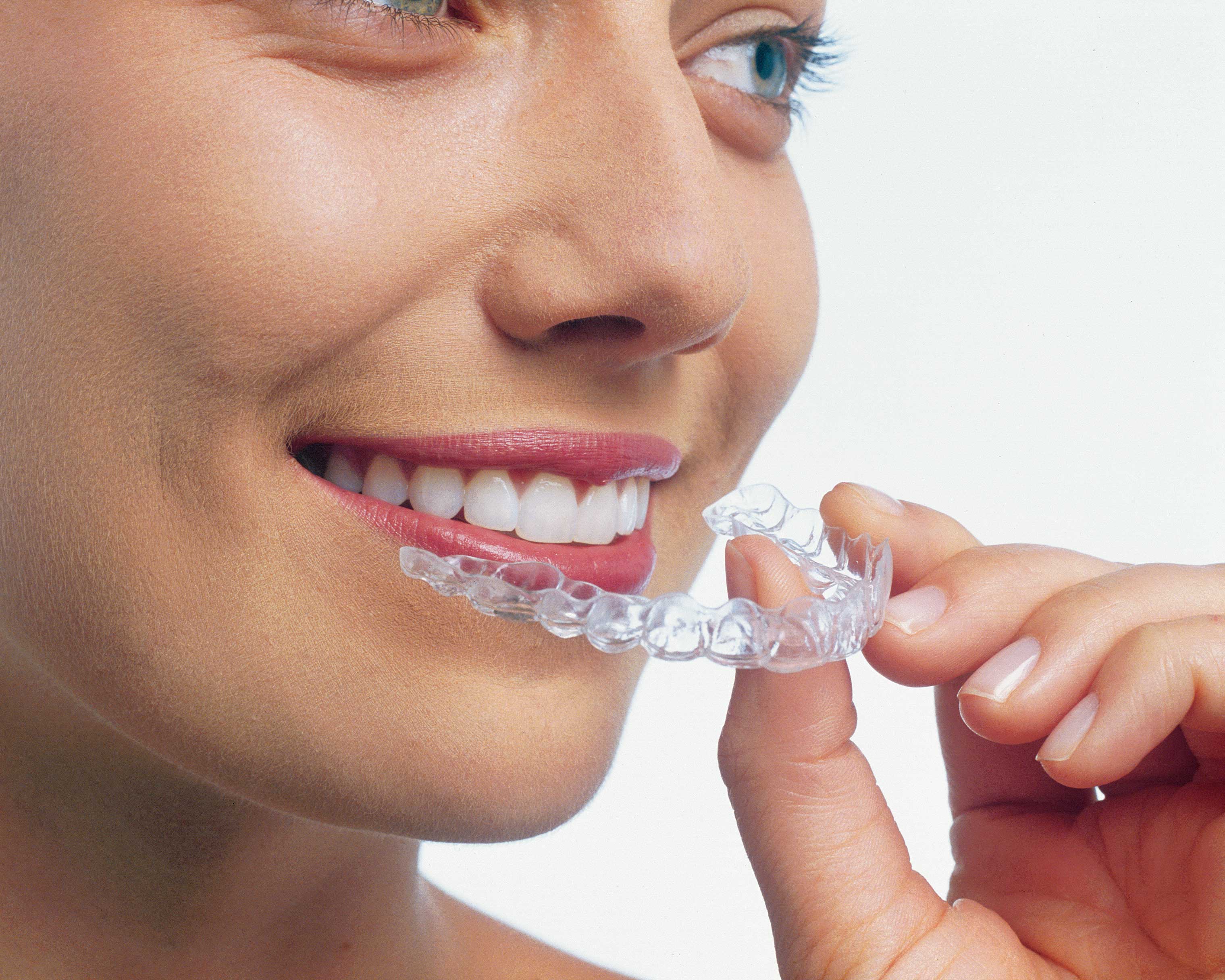 Сведения о системе коррекции каппами invisalign
