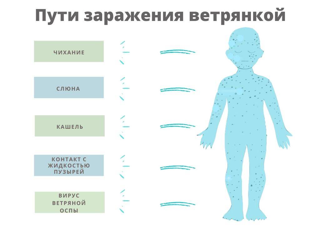 Как начинается ветрянка у детей: первые признаки (фото), начальная стадия