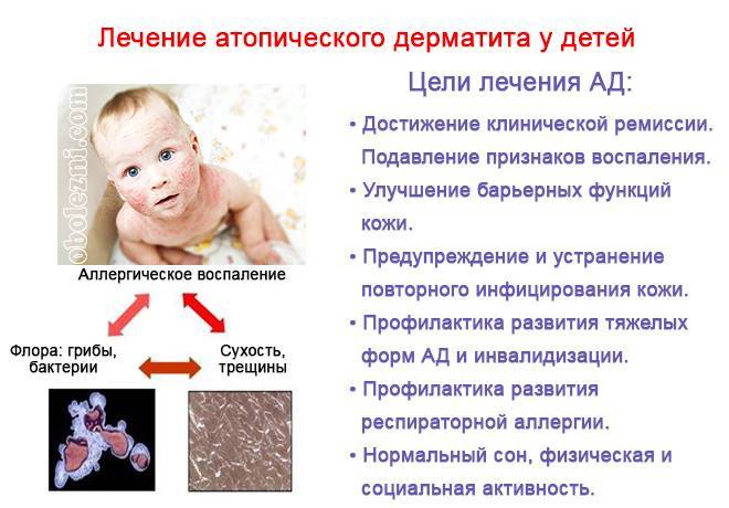 Чем отличается атопический дерматит от аллергического, разница