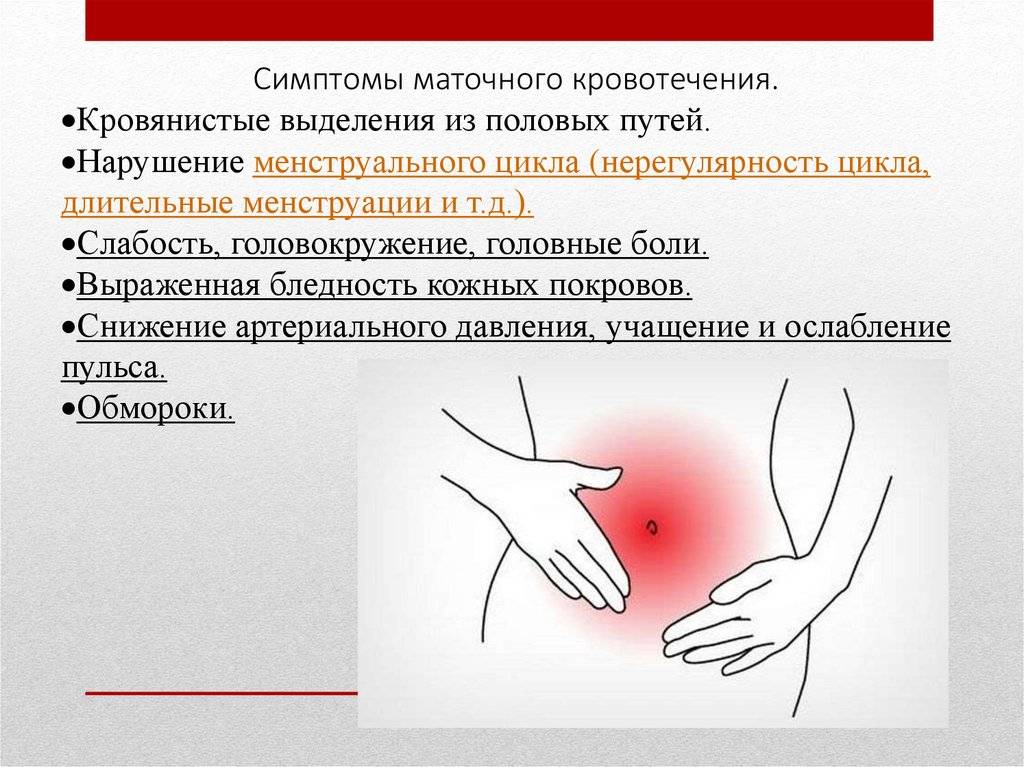 Кровотечение при беременности