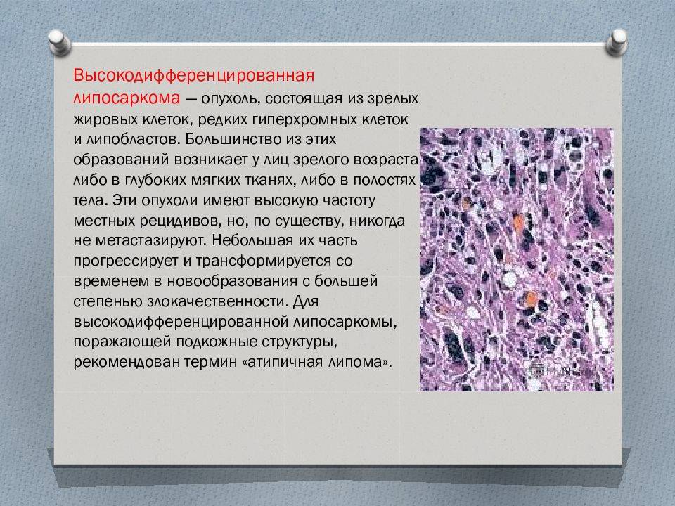 Липома (жировик, липобластома, жировая опухоль) - симптомы и лечение. журнал медикал
