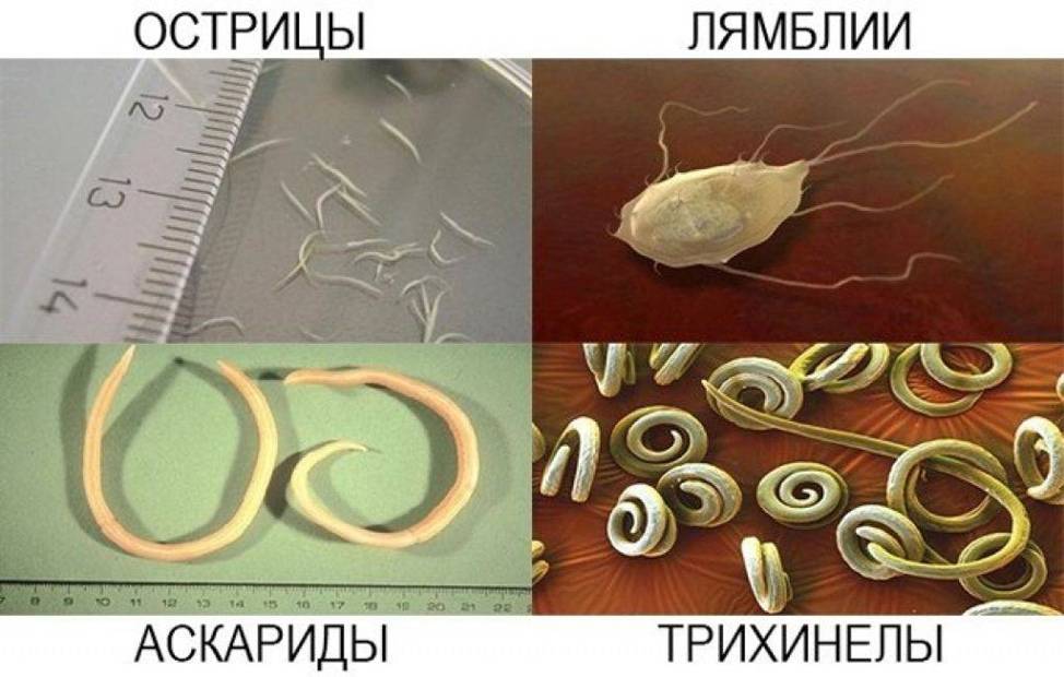 Анализ на острицы и аскариды. как отличить остриц от аскарид. чем отличаются аскариды и острицы