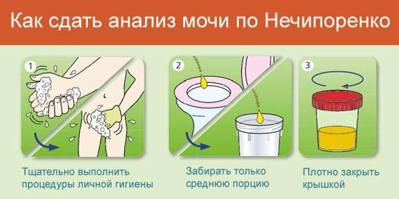 Норма по анализу мочи по нечипоренко | что показывает анализ мочи по нечипоренко